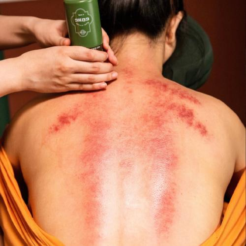 Giảm đau nhức cơ thể