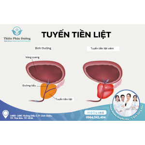 Một Số Phương Pháp Điều Trị Bệnh Viêm Tuyến Tiền Liệt