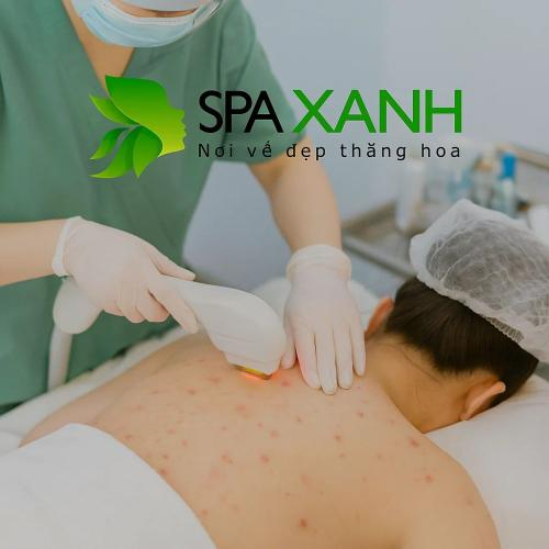 Thâm Sau Mụn Có Tự Hết Không?