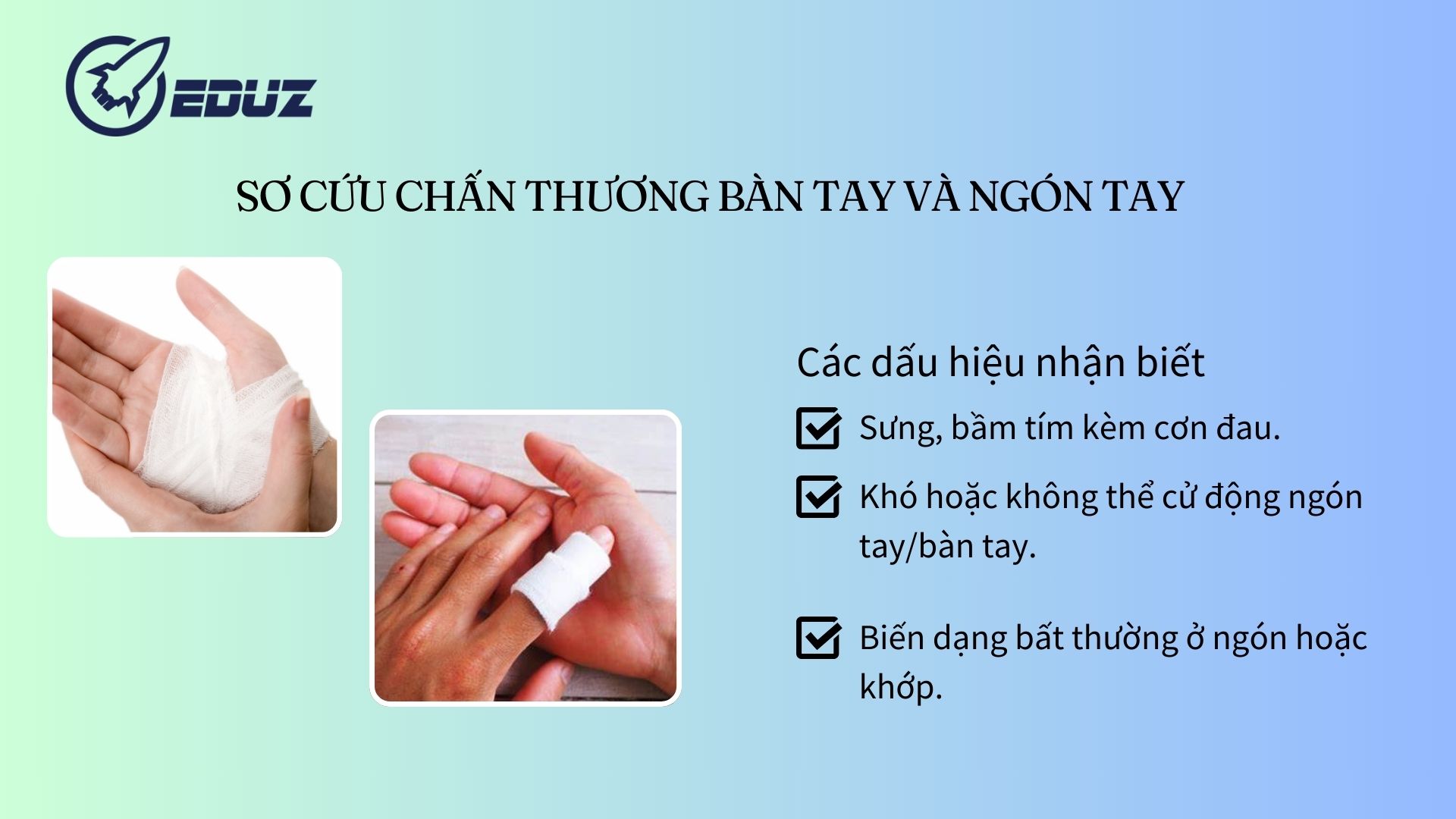 1. Sơ cứu chấn thương bàn tay và ngón tay