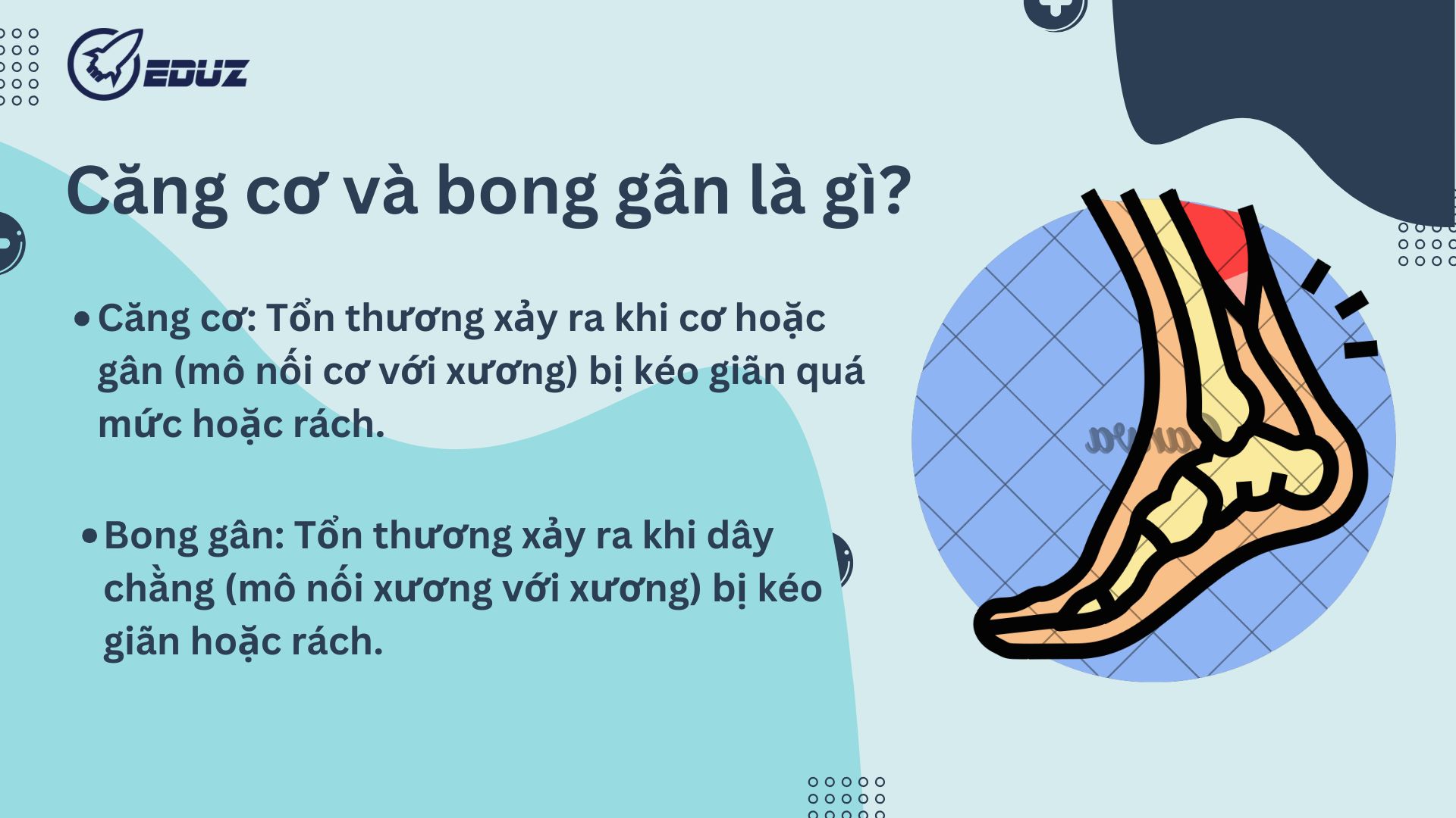 1.Căng cơ và bong gân là gì?