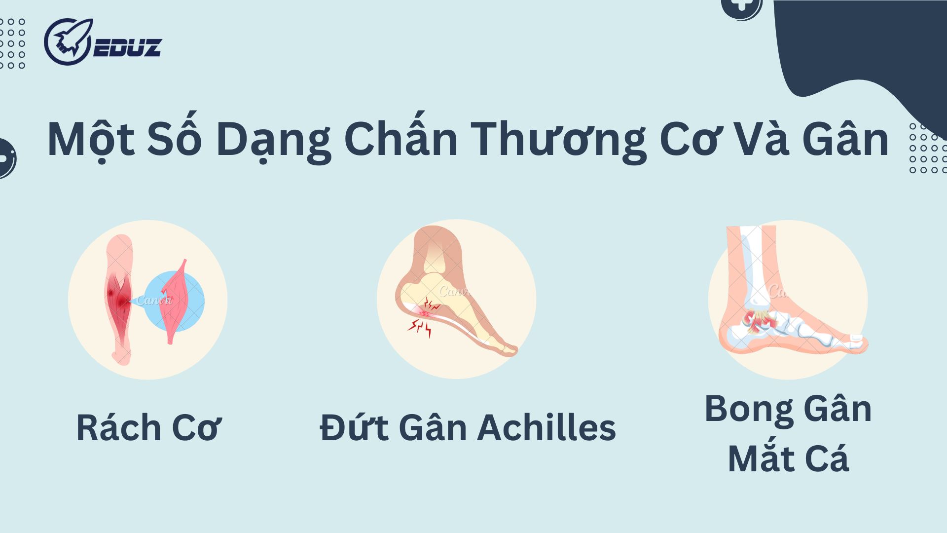 Một Số Dạng Chấn Thương Cơ Và Gân