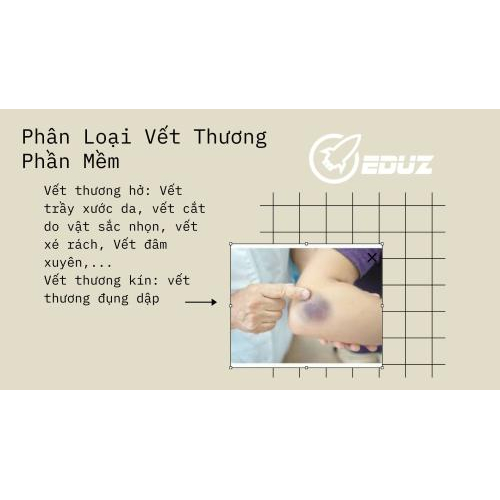 II. Phân Loại Vết Thương Phần Mềm
