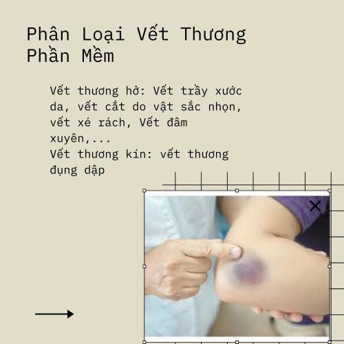 Vết Thương Phần Mềm