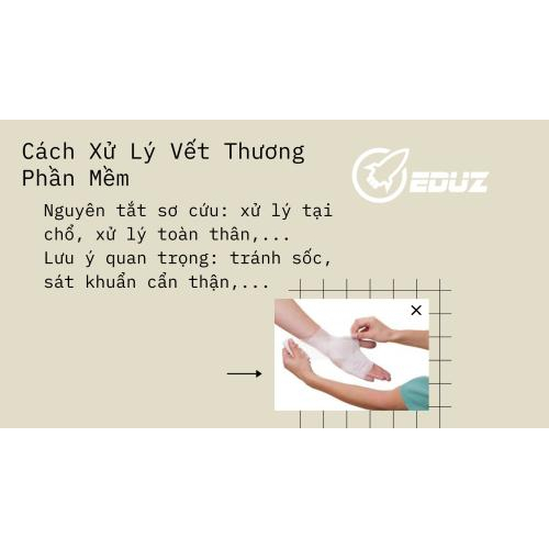 III. Cách Xử Lý Vết Thương Phần Mềm