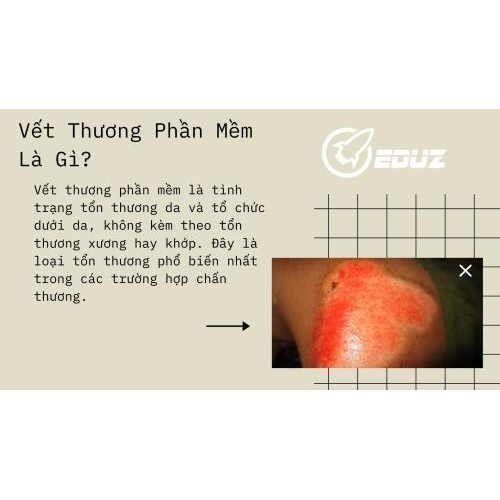 I. Vết Thương Phần Mềm Là Gì?