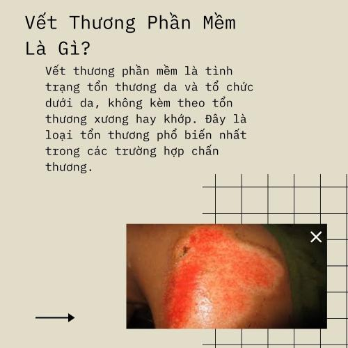 Vết Thương Phần Mềm