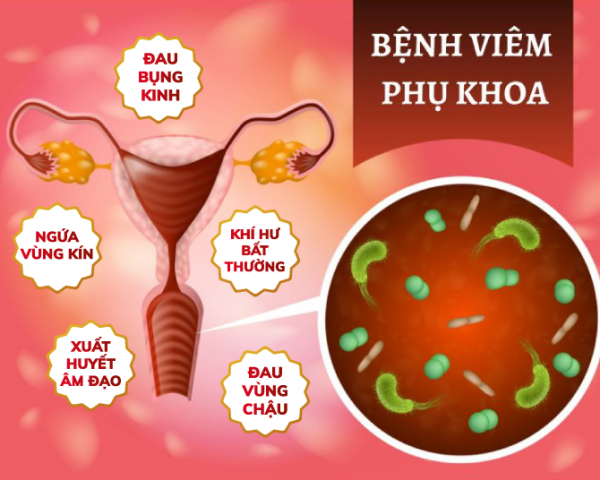 Viêm Phụ Khoa Và Dấu Hiệu Nhận Biết