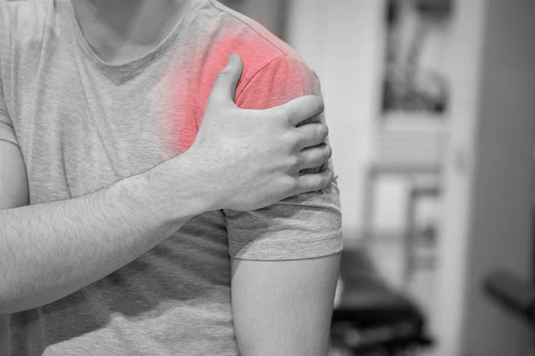 Bỏ túi ngay 6 nguyên nhân gây ĐAU BẢ VAI LAN XUỐNG CÁNH TAY - Cẩn thận kẻo muộn!